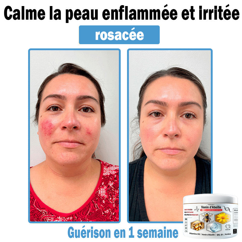 TODAH๐ข๐ยฎ ๐ฟ ๐พ๐งรจ๐ข๐ ๐๐ช๐ก๐ฉ๐-๐๐ฎ๐ข๐ฅ๐ฉรด๐ข๐๐จ ๐๐ช ๐๐๐ฃ๐๐ฃ ๐'๐ผ๐๐๐๐ก๐ก๐  (๐ฉโโ๏ธ๐๐๐๐จ๐ฆ๐ฆ๐๐ง๐รฉ๐ ๐ฉ๐๐ซ ๐ฅ'๐๐๐๐)