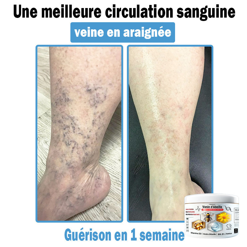 TODAH๐ข๐ยฎ ๐ฟ ๐พ๐งรจ๐ข๐ ๐๐ช๐ก๐ฉ๐-๐๐ฎ๐ข๐ฅ๐ฉรด๐ข๐๐จ ๐๐ช ๐๐๐ฃ๐๐ฃ ๐'๐ผ๐๐๐๐ก๐ก๐  (๐ฉโโ๏ธ๐๐๐๐จ๐ฆ๐ฆ๐๐ง๐รฉ๐ ๐ฉ๐๐ซ ๐ฅ'๐๐๐๐)