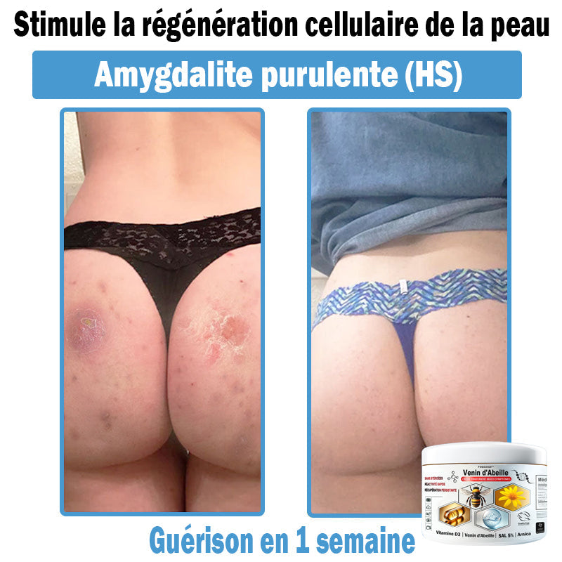 TODAH๐ข๐ยฎ ๐ฟ ๐พ๐งรจ๐ข๐ ๐๐ช๐ก๐ฉ๐-๐๐ฎ๐ข๐ฅ๐ฉรด๐ข๐๐จ ๐๐ช ๐๐๐ฃ๐๐ฃ ๐'๐ผ๐๐๐๐ก๐ก๐  (๐ฉโโ๏ธ๐๐๐๐จ๐ฆ๐ฆ๐๐ง๐รฉ๐ ๐ฉ๐๐ซ ๐ฅ'๐๐๐๐)